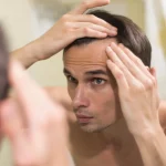 trattamenti anticaduta capelli uomo
