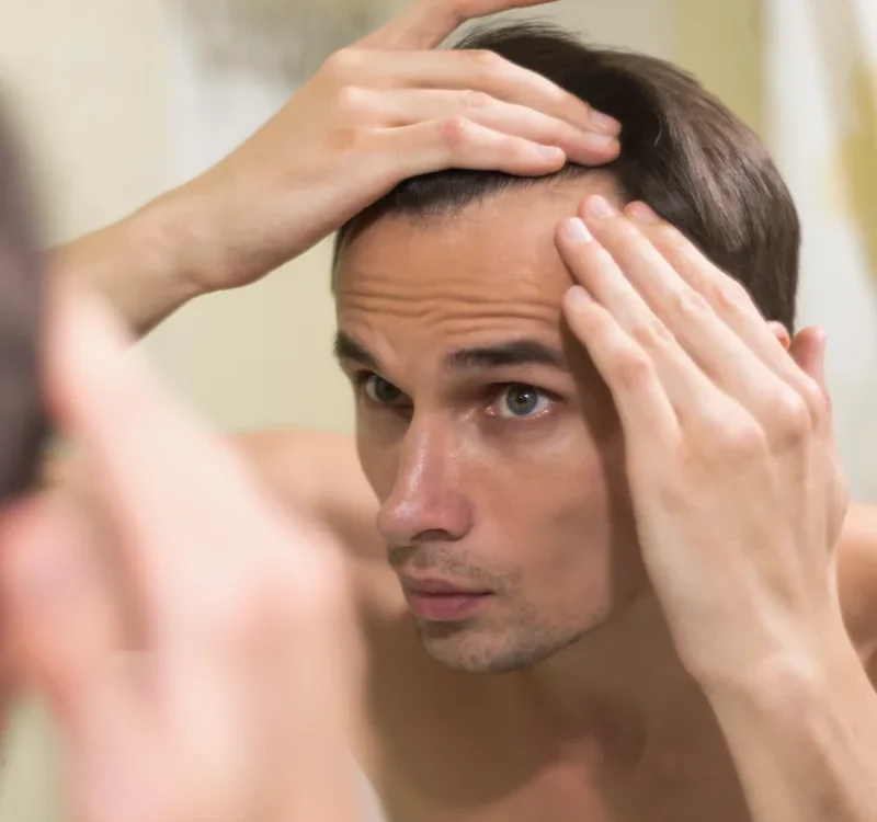 trattamenti anticaduta capelli uomo